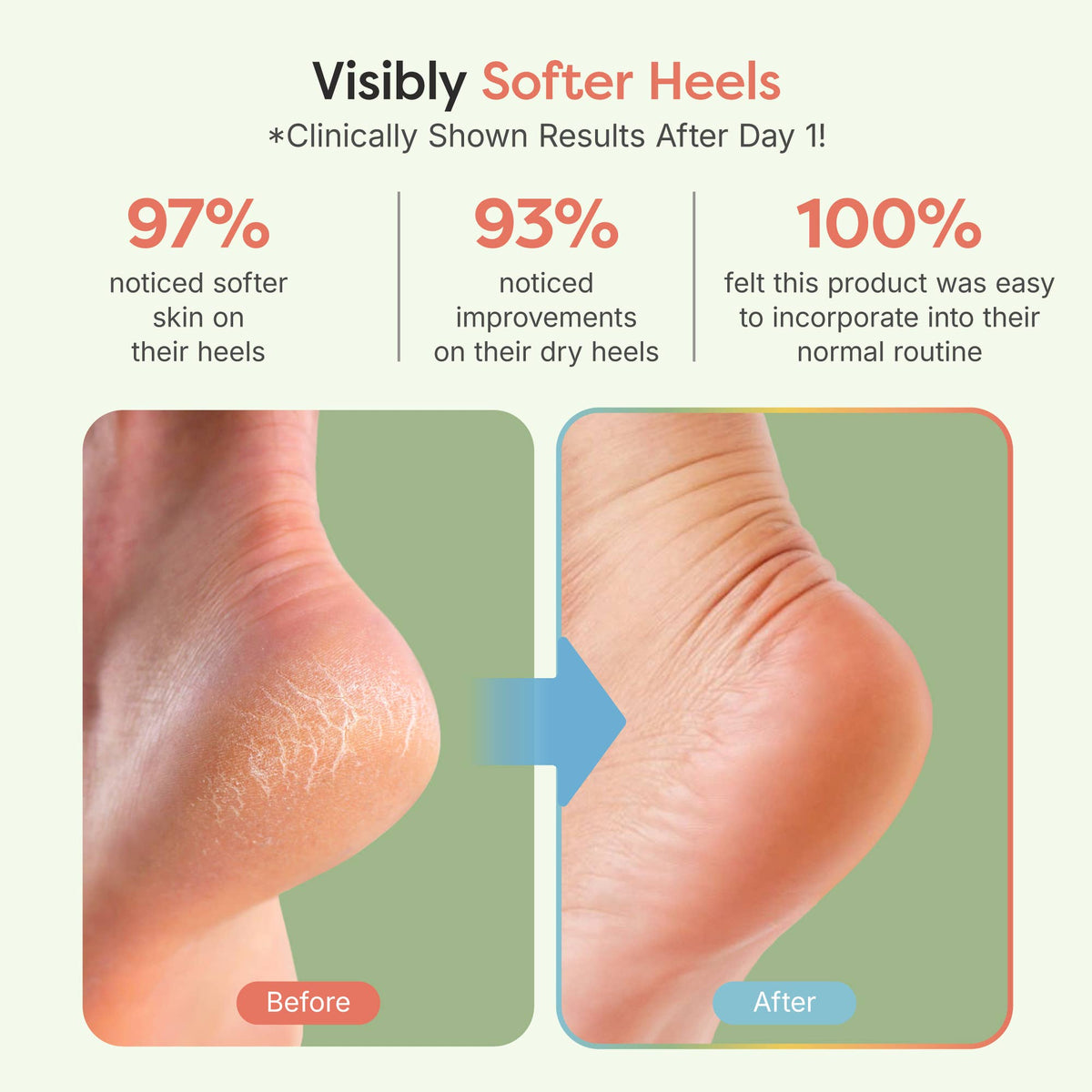 Moisturizing Heel Socks - 1 Pair - Fuzzy